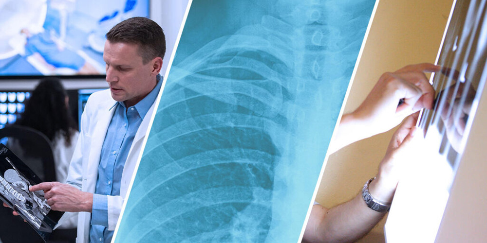 Split image of different radiology scenes