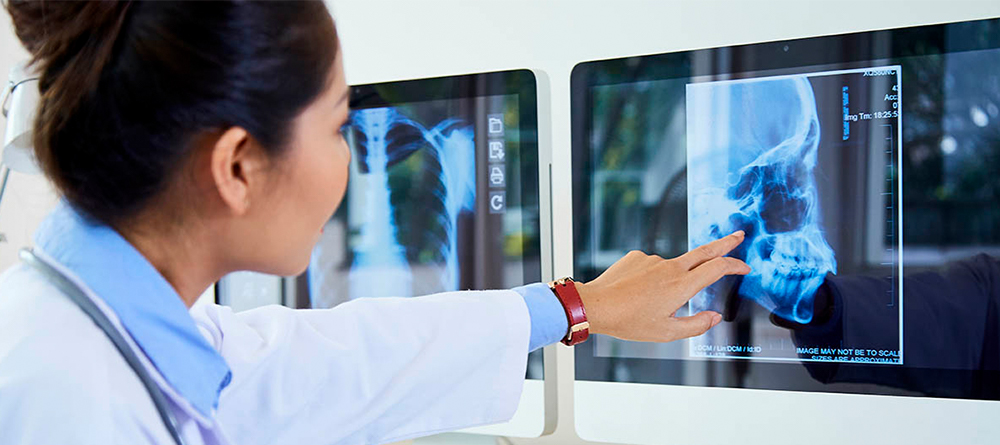 Doctor reviewing MRI