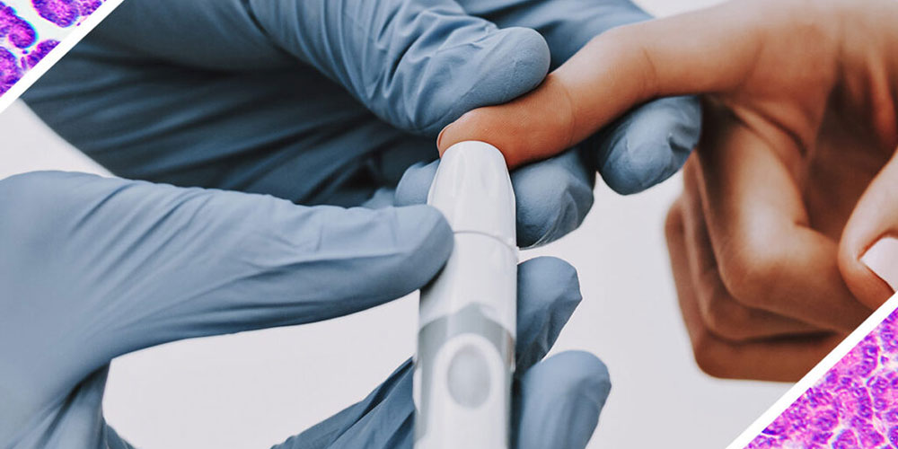 What Is Insulin Resistance?