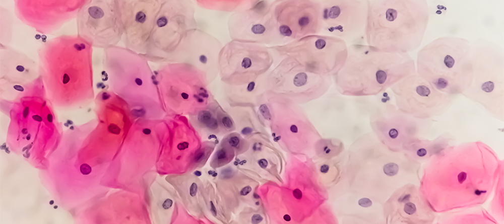 HPV Under Microscope