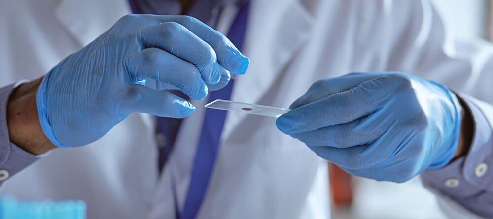 Close up of a hematology oncologist examining a blood sample